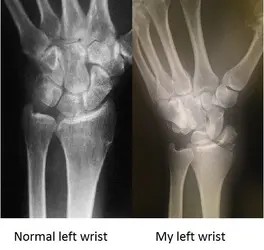 $wrists.webp