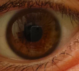 $eye2.webp