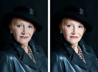 $Before-and-After.webp
