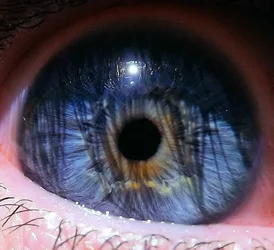 $eye3.webp $eye3.webp