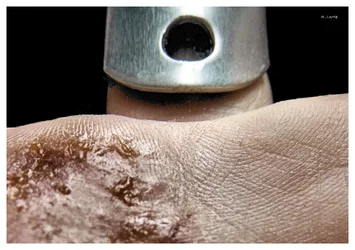 wound sig.webp