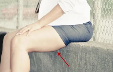 $legbulge.webp