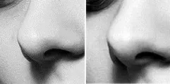 nose.webp