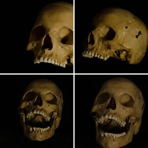 Skull pictures