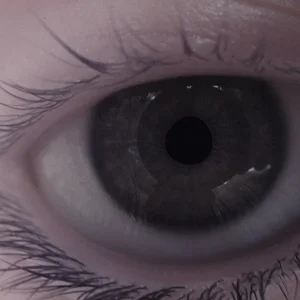 eye R