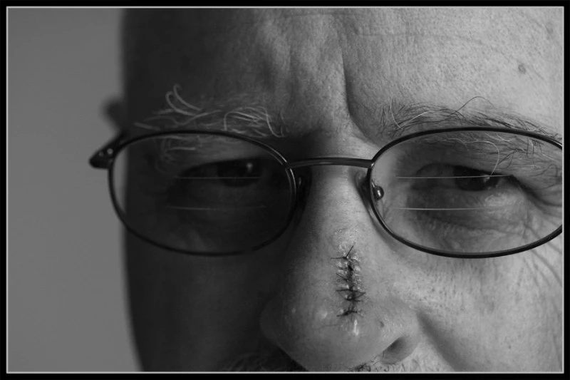 june08photo03-In the shadow of cancer