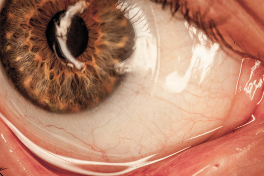 eye_series_part_2_by_er111a-d5ckku0.jpg
