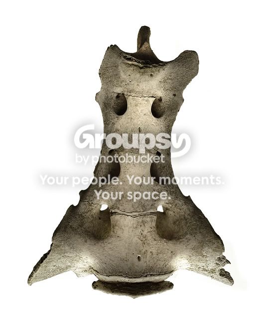 bone2-sm.jpg