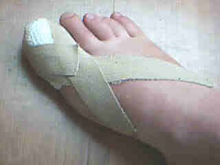 poortoe1.jpg