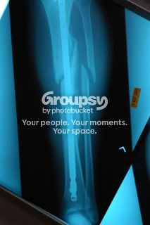 X-Rays003.jpg